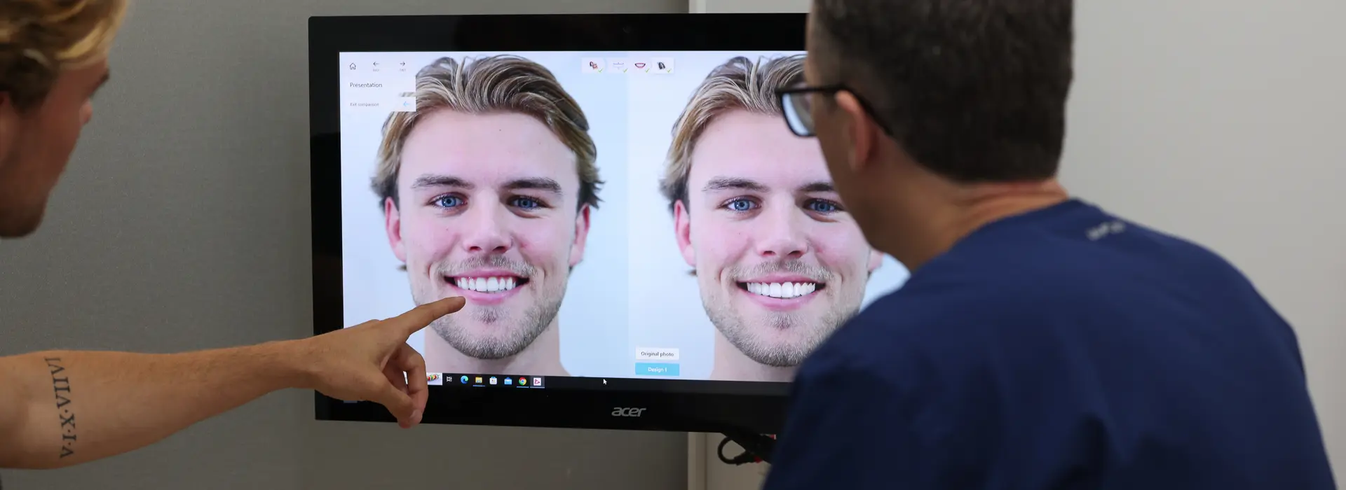 smile design brisbane dentist