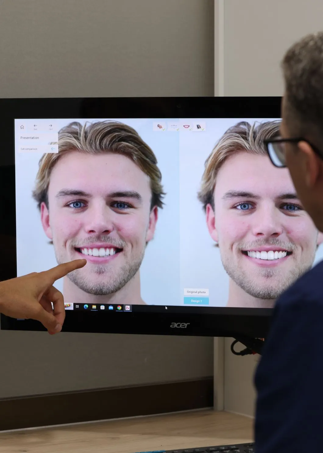brisbane veneers consult free