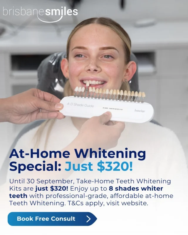 Take-Home Teeth Whitening Special: Just $320 Until 30 September! ✨ Brighten your smile from the comfort of your home with our professional custom Take-Home Whitening Kits, now available at the special price of $320 (original price $450)!
Achieve up to 8 shades whiter teeth in just 1-2 weeks using custom-fitted reusable trays and professional-grade gel, guided by your Oral Health Professional.
💎 This offer is ideal for a Spring-time refresh or for a special event coming up!
Offer valid for EXISTING PATIENTS ONLY 👉 Book your FREE Whitening Consult today: link in bio.
#teethwhiteningspecial #brisbanedentist #teethwhiteningbrisbane
*Suitability assessed in consultation.Treatment risks may apply; suitability varies. A full exam, consultation, and informed consent are required. View full T&Cs on our website.