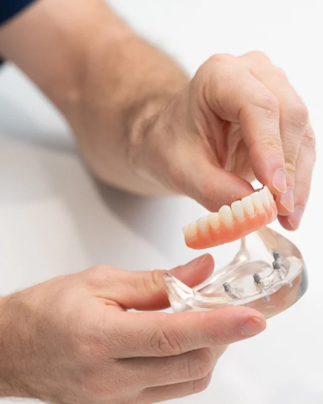 Dental Implants at Brisbane Smiles! 🦷✨

This innovative treatment for missing teeth is a long-term solution that restores function, appearance, and helps prevent bone shrinkage. At Brisbane Smiles, we use state-of-the-art technology and a 3-step process to create secure, lasting results. 

From your first consult to your final smile, we assist in supporting you to be informed, comfortable, and being part of the process every step of the way. 💙 ✨

Contact us today at 3870 3333 or learn more via the link in our bio 

#BrisbaneSmiles #dentalimplants #brisbanedentist 

⚠️Treatment outcomes differ for each individual and cannot be guaranteed. All photos and videos feature actual patients and are for informational purposes only. All surgical or invasive procedures carry risks. Before proceeding, consult a qualified health practitioner and seek a second opinion. Go to bsmiles.au/txinfo to learn about potential risks and important treatment considerations.