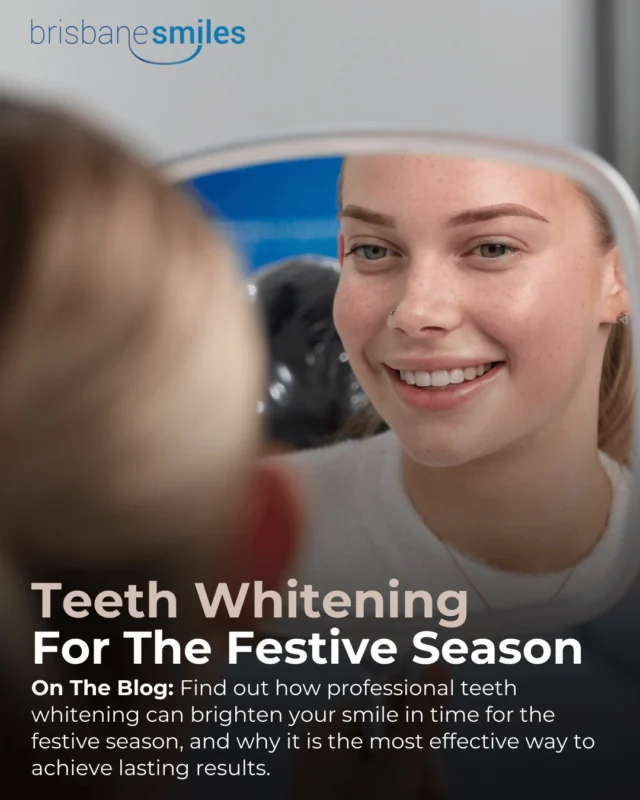 Now Is the Perfect Time To Brighten Your Smile for the Festive Season! ✨

Professional Teeth Whitening can safely remove stubborn stains, enhance your teeth’s natural brightness, and give long-lasting results. Find out the best professional whitening options, from in-chair treatments to take-home trays, and learn how to maintain that bright smile throughout all your festive celebrations. 🎄

Learn more about professional teeth whitening in our newest blog via the link in our bio.

#brisbanesmiles #brisbanedentist #generaldentist #teethwhitening 

⚠️ Treatment outcomes differ for each individual and cannot be guaranteed. All photos and videos feature actual patients and are for informational purposes only. All surgical or invasive procedures carry risks. Before proceeding, consult a qualified health practitioner and seek a second opinion. Go to bsmiles.au/txinfo to learn about potential risks and important treatment considerations.
