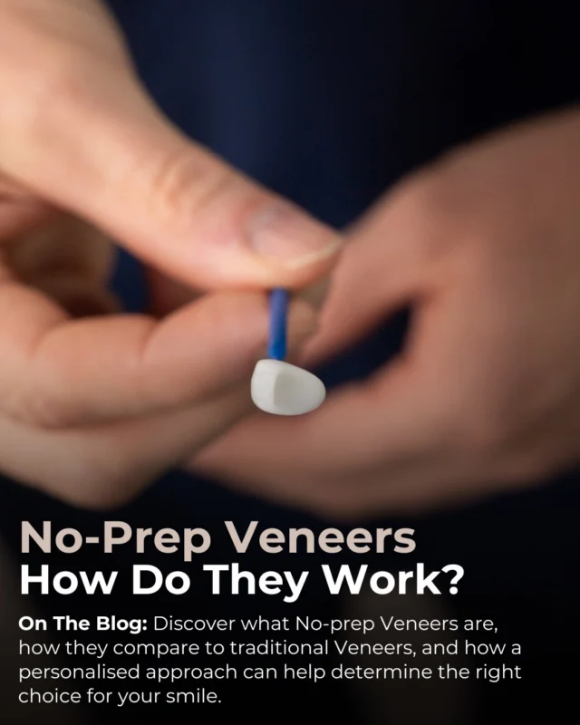 Curious about No-prep Veneers? 🦷

No-prep Porcelain Veneers are a minimally invasive option designed to enhance your smile while preserving your natural tooth structure. While No-prep Veneers offer a conservative, minimally invasive approach, they may not always be suitable for every patient. 

Learn more in our latest blog whether this minimally invasive option could be suitable for you - link in bio

#NoPrepVeneers #Brisbanedentist #BrisbaneVeneers

⚠️ Treatment outcomes differ for each individual and cannot be guaranteed. All photos and videos feature actual patients and are for informational purposes only. All surgical or invasive procedures carry risks. Before proceeding, consult a qualified health practitioner and seek a second opinion. Go to bsmiles.au/txinfo to learn about potential risks and important treatment considerations.