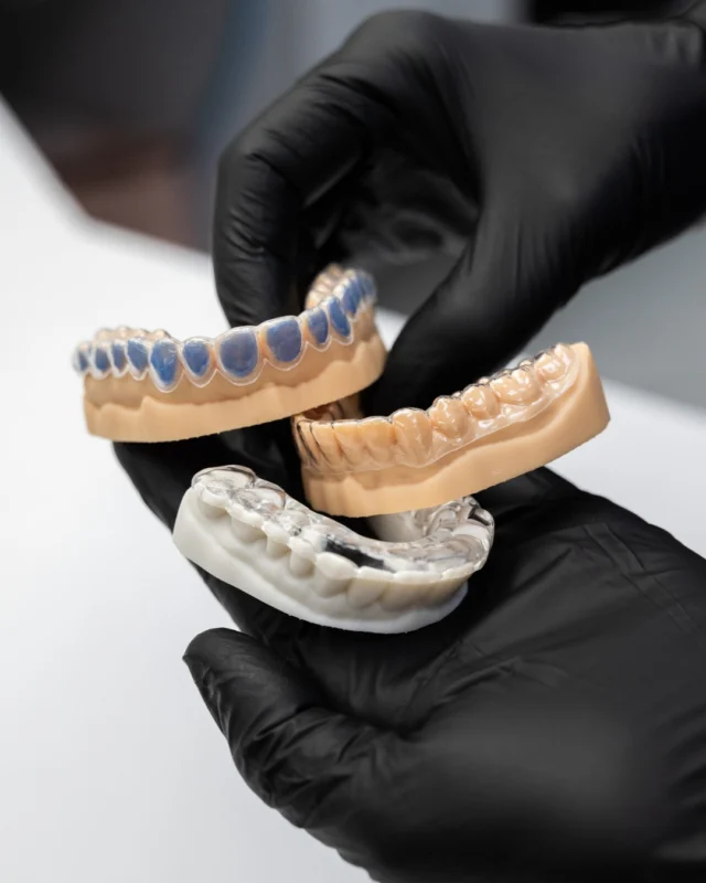 Hand-crafted Dental Appliances at the Brisbane Smiles in-house Dental Laboratory 💎🦷 

At Brisbane Smiles, our in-house Dental Lab is where precision meets innovation. Every appliance and restoration is custom-made with care right here by our skilled team for comfort, accuracy, and long-lasting results.

Pictured here are examples of custom dental appliances crafted in our lab, including:
✨ A Teeth Whitening tray
✨ A clear Retainer for post-orthodontic or Invisalign treatment
✨ An Occlusal Splint designed to protect teeth from grinding and clenching

By having our laboratory in-house, we can deliver personalised dentistry with exceptional quality, precision, and efficiency all under one roof.

To learn more about our in-house Dental Laboratory or to book an appointment, visit the link in our bio or call our friendly team on 3870 3333. 💙

#brisbanesmiles #bsmilesdentallab #dentalrestorationsbrisbane

⚠️Treatment outcomes differ for each individual and cannot be guaranteed. All photos and videos feature actual patients and are for informational purposes only. All surgical or invasive procedures carry risks. Before proceeding, consult a qualified health practitioner and seek a second opinion. Go to bsmiles.au/txinfo to learn about potential risks and important treatment considerations.