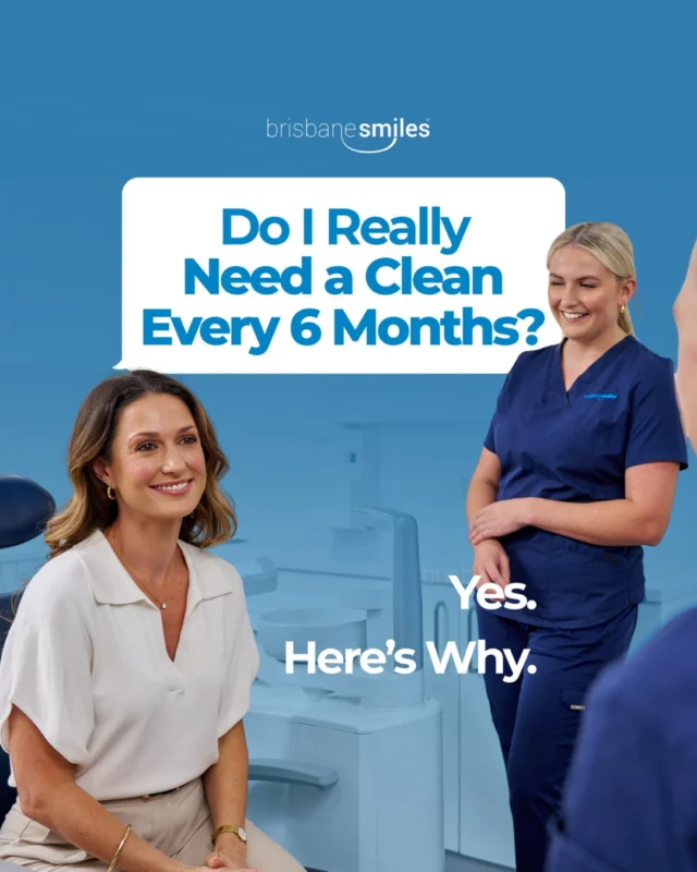 "Do I really need a clean every 6 months?"

Short answer, yes. Here's why:

Plaque forms constantly, it's a natural process you can't fully stop at home. Brushing and flossing get most of it, but a professional clean removes the plaque and tartar hiding in the spots your toothbrush can't reach.

Regular cleans also mean small issues get caught before they become big (expensive) ones.

Due for a check-up and clean? Book online at www.bsmiles.au or call 3870 3333.

#brisbanesmiles #dentalclean #oralhealth

⚠️ Treatment outcomes differ for each individual and cannot be guaranteed. All photos and videos are for informational purposes only. All surgical or invasive procedures carry risks. Before proceeding, consult a qualified health practitioner and seek a second opinion. Go to bsmiles.au/txinfo to learn about potential risks and important treatment considerations.