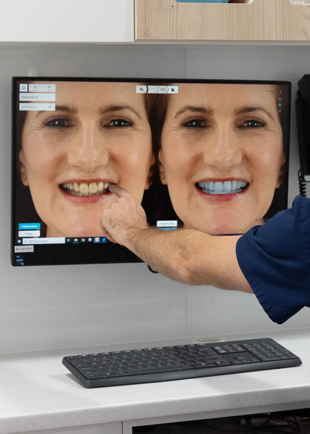 What Is a Smile Makeover?