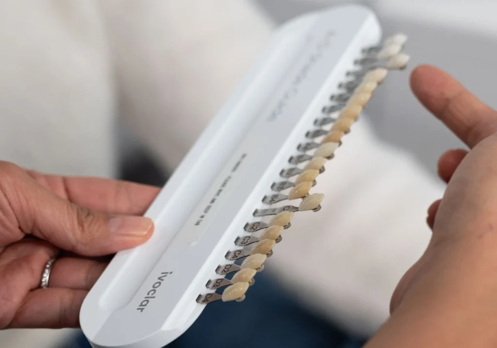 teeth whitening consult brisbane smiles
