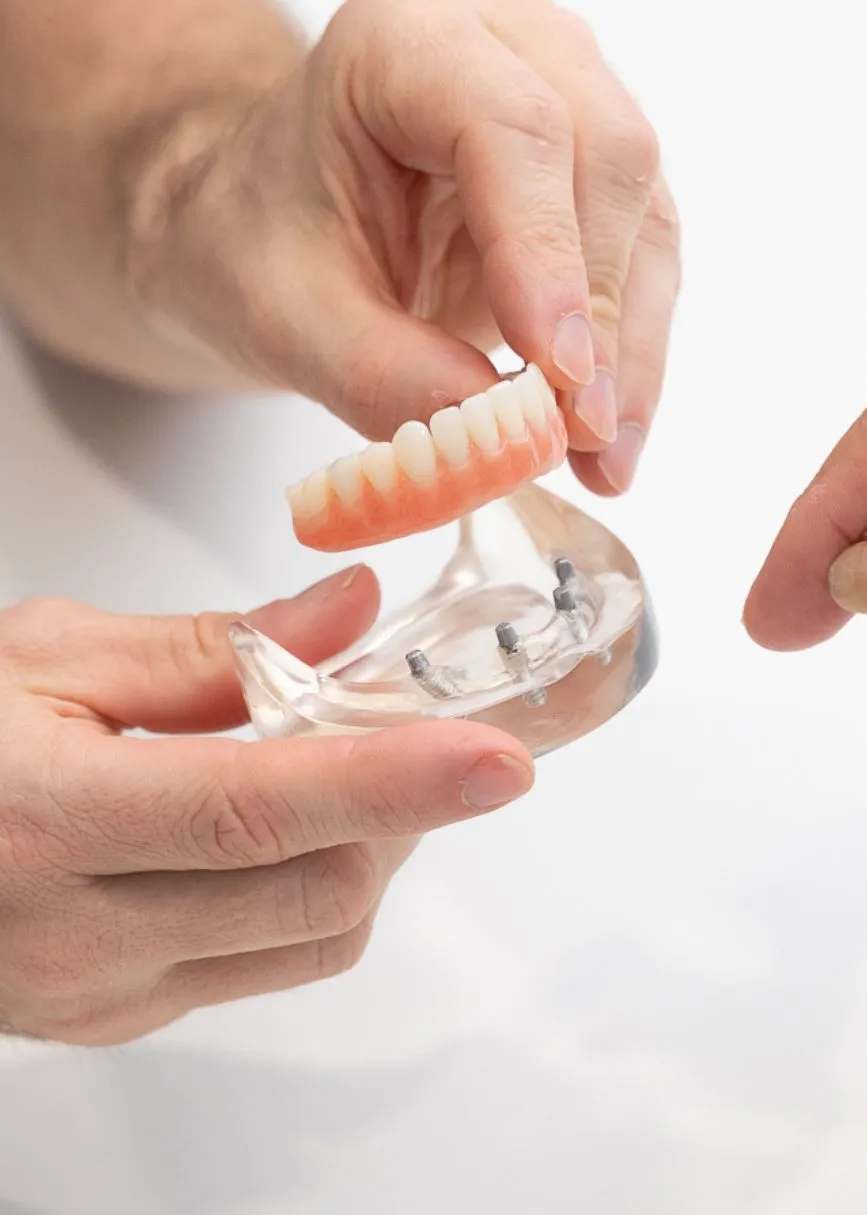 dental implants at brisbane smiles